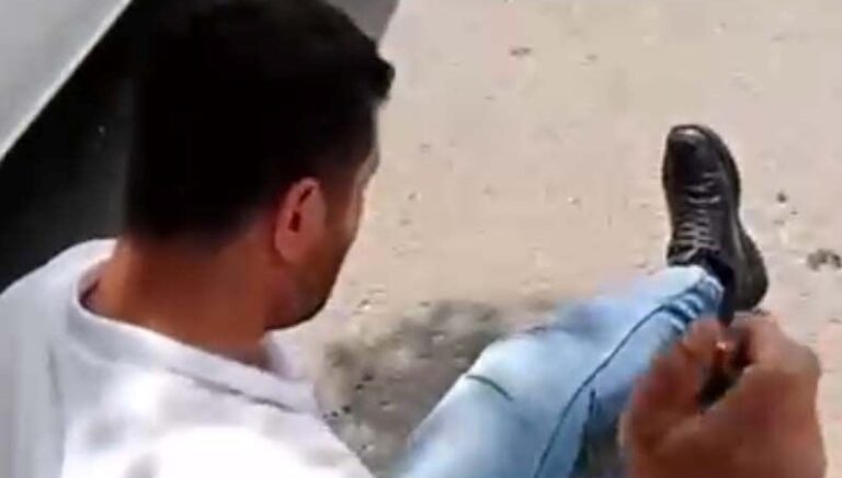 Bacaklarından vurup sosyal medyada paylaştı, tutuklandı Bacaklarından vurup sosyal medyada paylaştı, tutuklandı