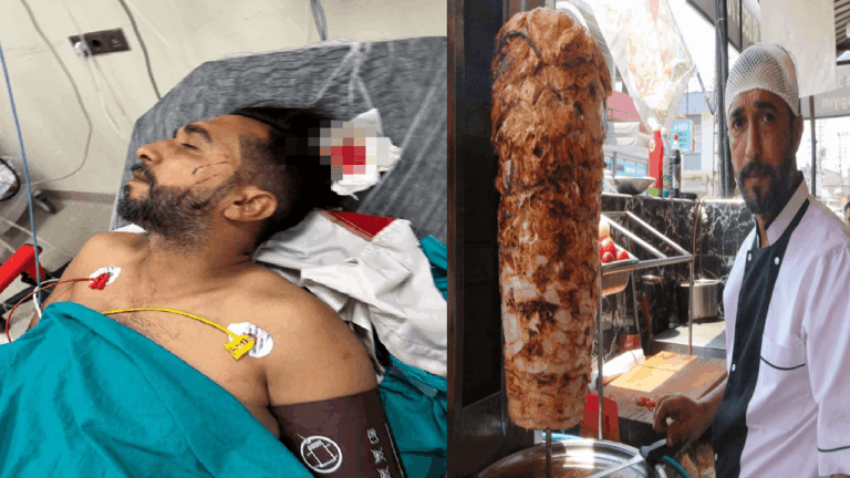 Döner ustasının başına mermi isabet etti Döner ustasının başına mermi isabet etti