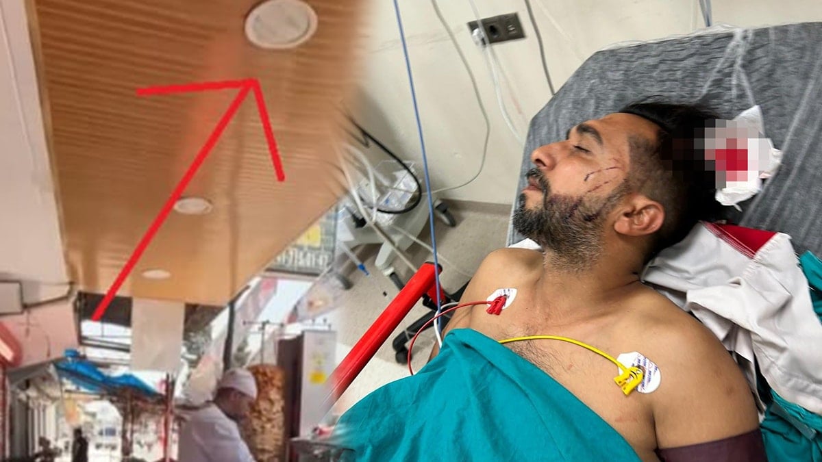 Döner yerken tavandan içeri giren kurşunla ağır yaralandı Döner yerken tavandan içeri giren kurşunla ağır yaralandı