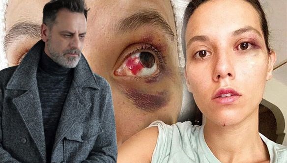 Ozan Güven’e hapis cezası Ozan Güven’e hapis cezası