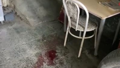 Sandalyeden düşen adam ağır yaralandı Sandalyeden düşen adam ağır yaralandı